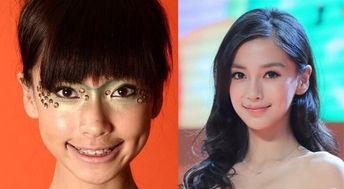 小孩牙套照片,见证孩子牙套成长瞬间